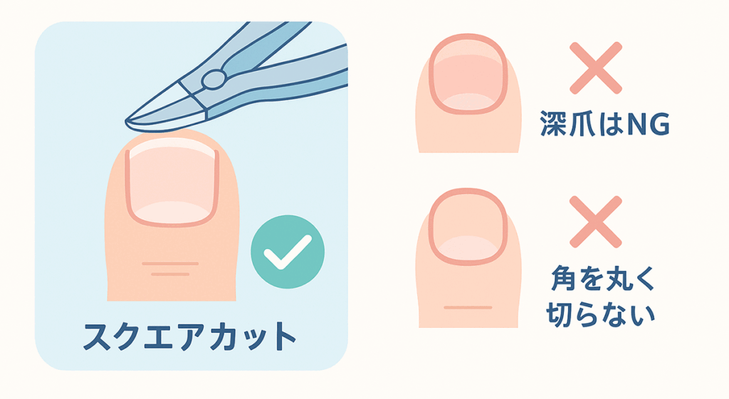 正しい爪切り「スクウェアカット」のイラスト画像、深爪はNG