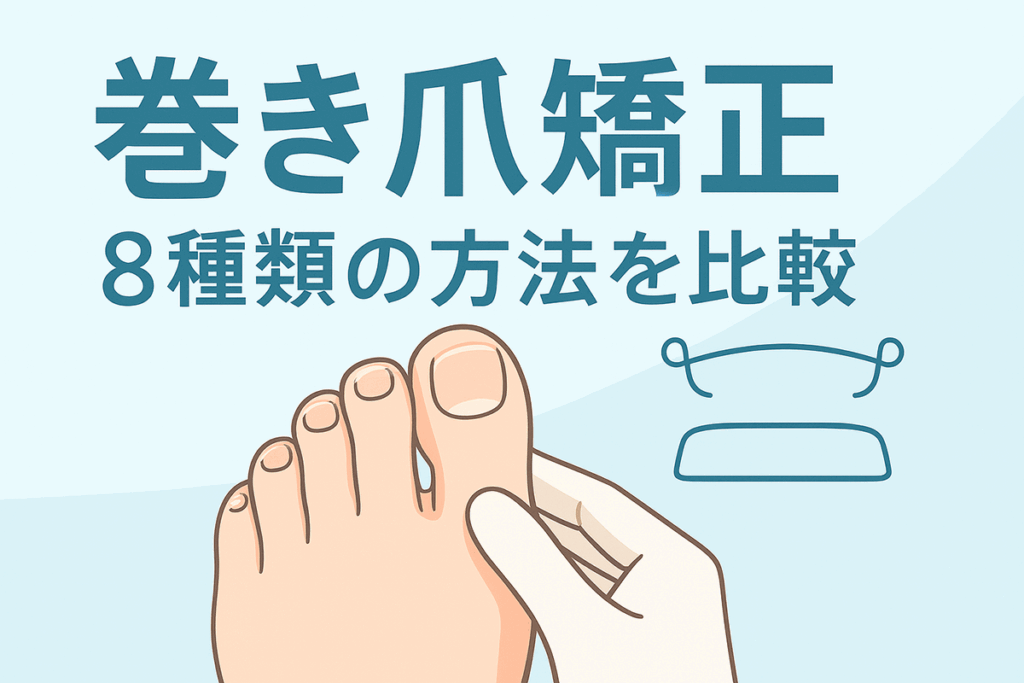 巻き爪の矯正8種類の方法を比較イラスト画像2