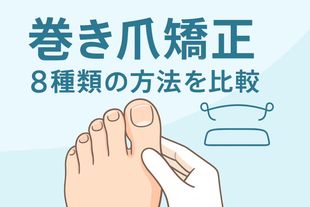 巻き爪の矯正8種類の方法を比較イラスト画像4