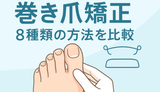 巻き爪の矯正8種類の方法を比較イラスト画像4