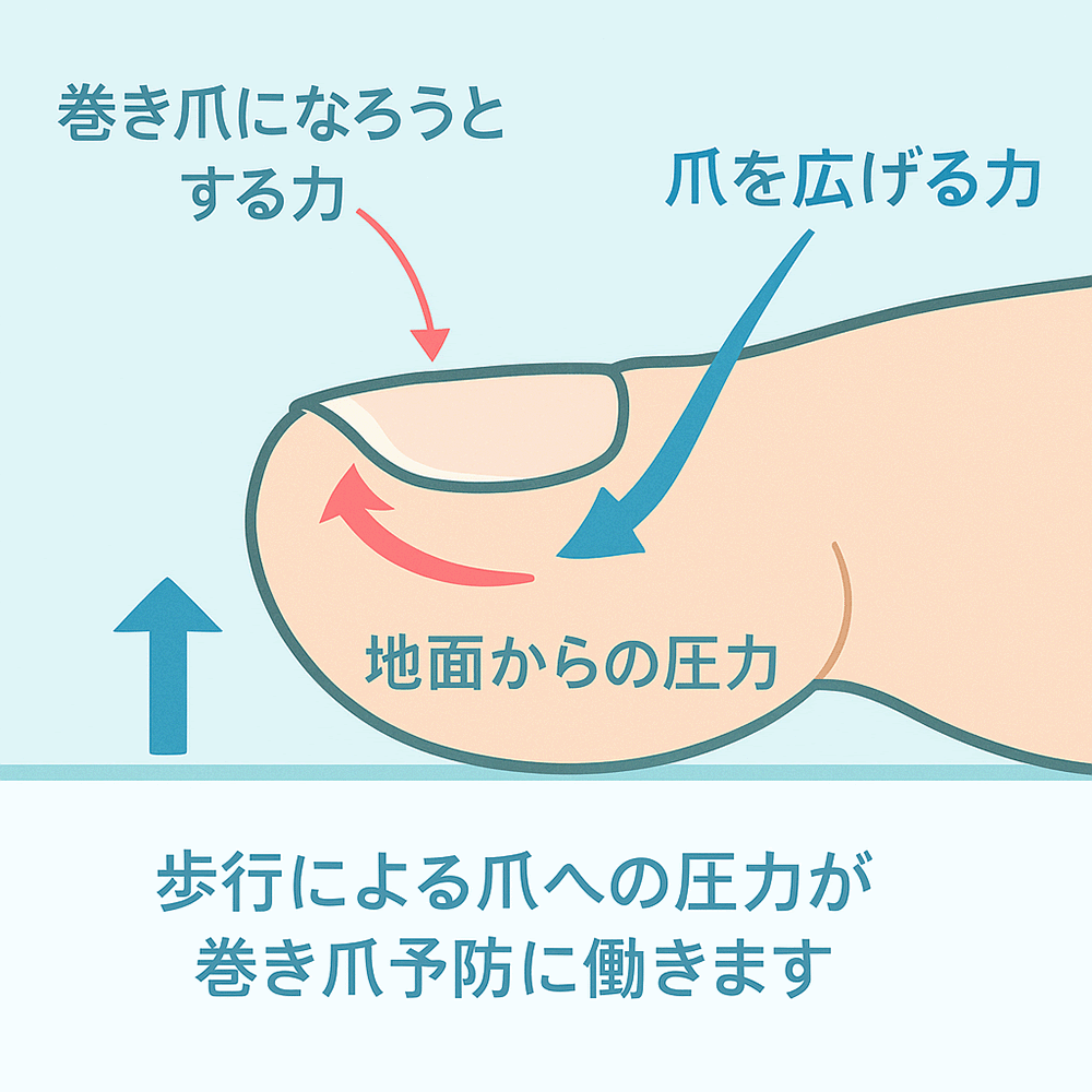 歩行による爪への圧力が巻き爪予防になることを説明したイラスト図