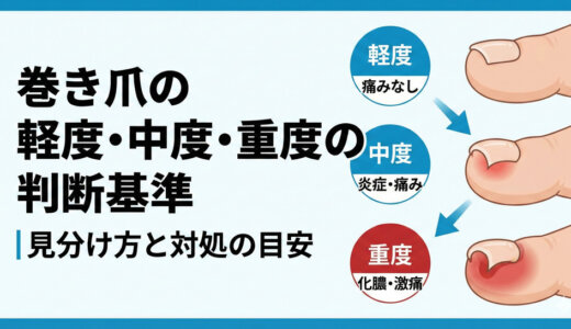 巻き爪の軽度・中道・重度の判断基準｜見分け方と対処の目安